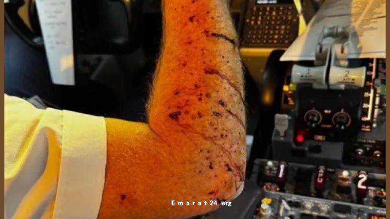 اصطدام طائرة ركاب بمنطاد طقس على ارتفاع شاهق وهبوط اضطراري ناجح