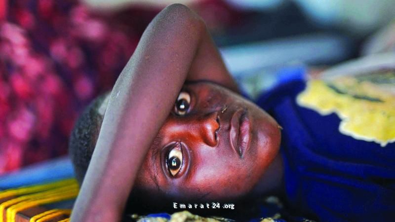 السودان يعاني أزمة الكوليرا الأسوأ منذ زمن طويل
