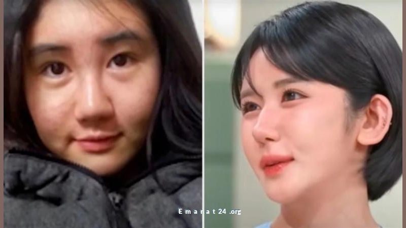 كورية تخضع لـ400 عملية تجميل لتحقيق المظهر المثالي كورية تخضع لـ400 عملية تجميل لتحقيق المظهر المثالي