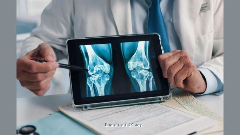 اكتشف غذاء متوفر يساهم في حماية العظام من الكسور والهشاشة اكتشف غذاء متوفر يساهم في حماية العظام من الكسور والهشاشة
