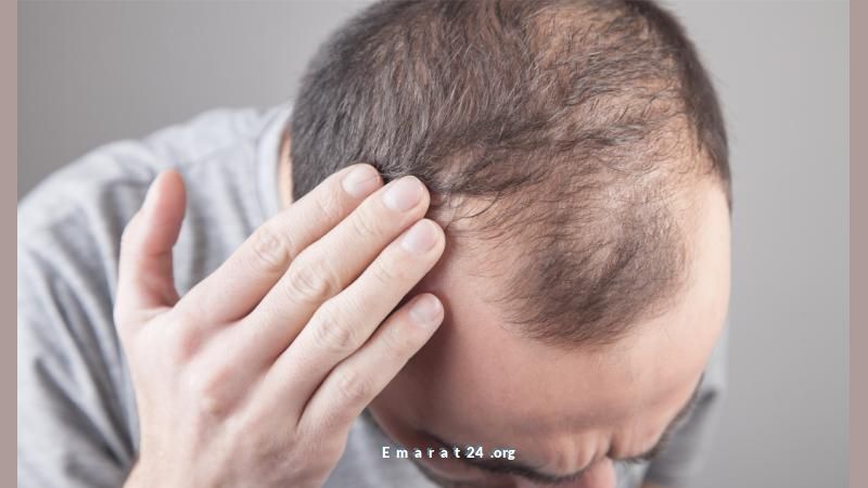 دراسة حديثة تكشف خبراً ساراً للرجال الصلع دراسة حديثة تكشف خبراً ساراً للرجال الصلع