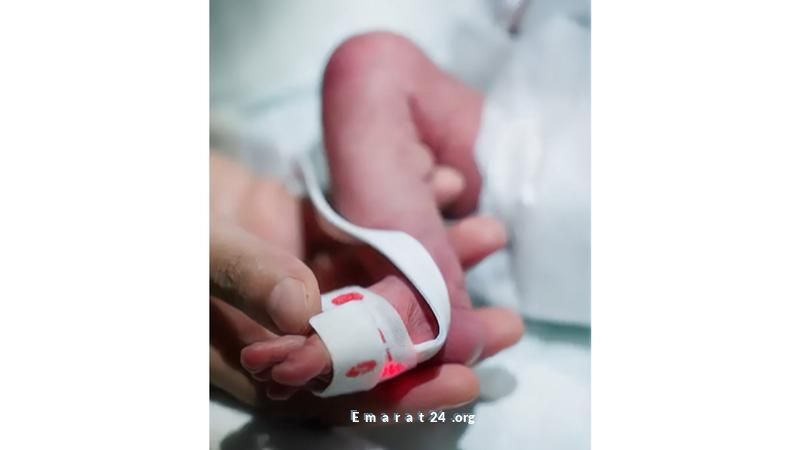 بعد 70 يوماً من العلاج بالأوكسجين، الطفلة روضة تتجاوز تحديات صحية معقدة بعد 70 يوماً من العلاج بالأوكسجين، الطفلة روضة تتجاوز تحديات صحية معقدة