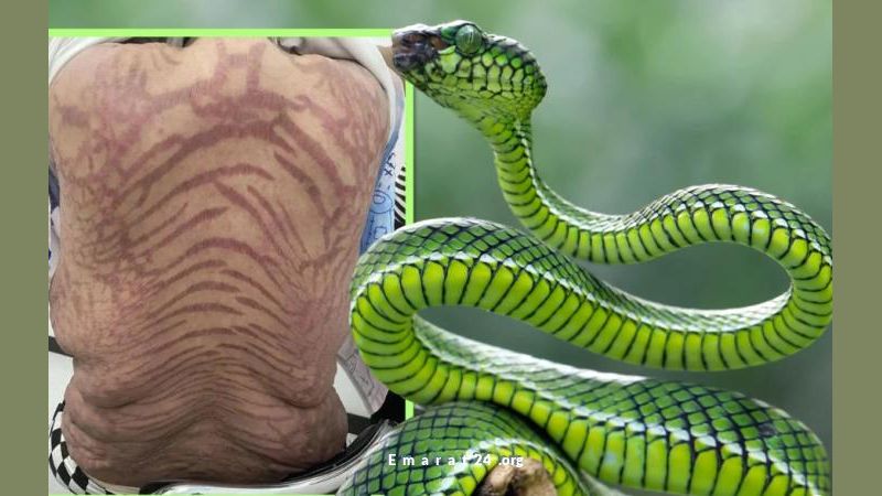 امرأة صينية تعاني من حالة جلدية مخيفة بسبب مرهم طبيعي مزعوم