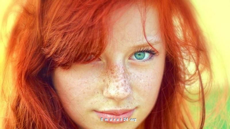 علماء: حاملو الجينات الحمراء يواجهون صعوبة في التئام الجروح