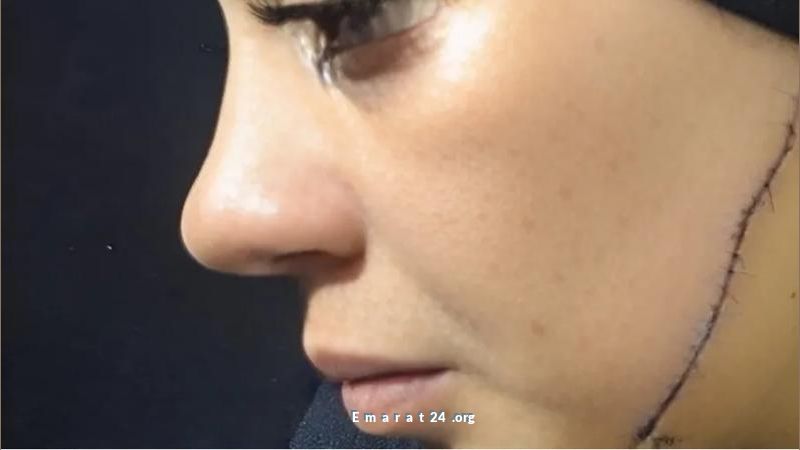 امرأة تهاجم عروس بالسّكين قبل ليلة زفافها من طليقها امرأة تهاجم عروس بالسّكين قبل ليلة زفافها من طليقها
